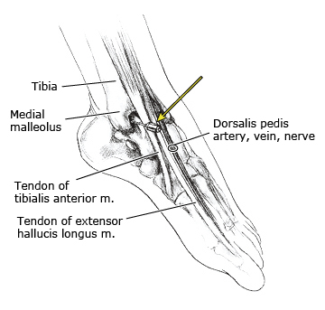 block-ankleasp_ankleasp.jpg