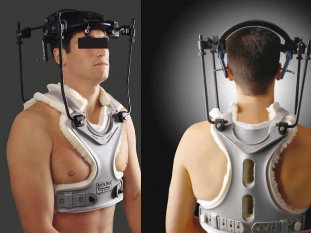 splint-spineorthoses_halo