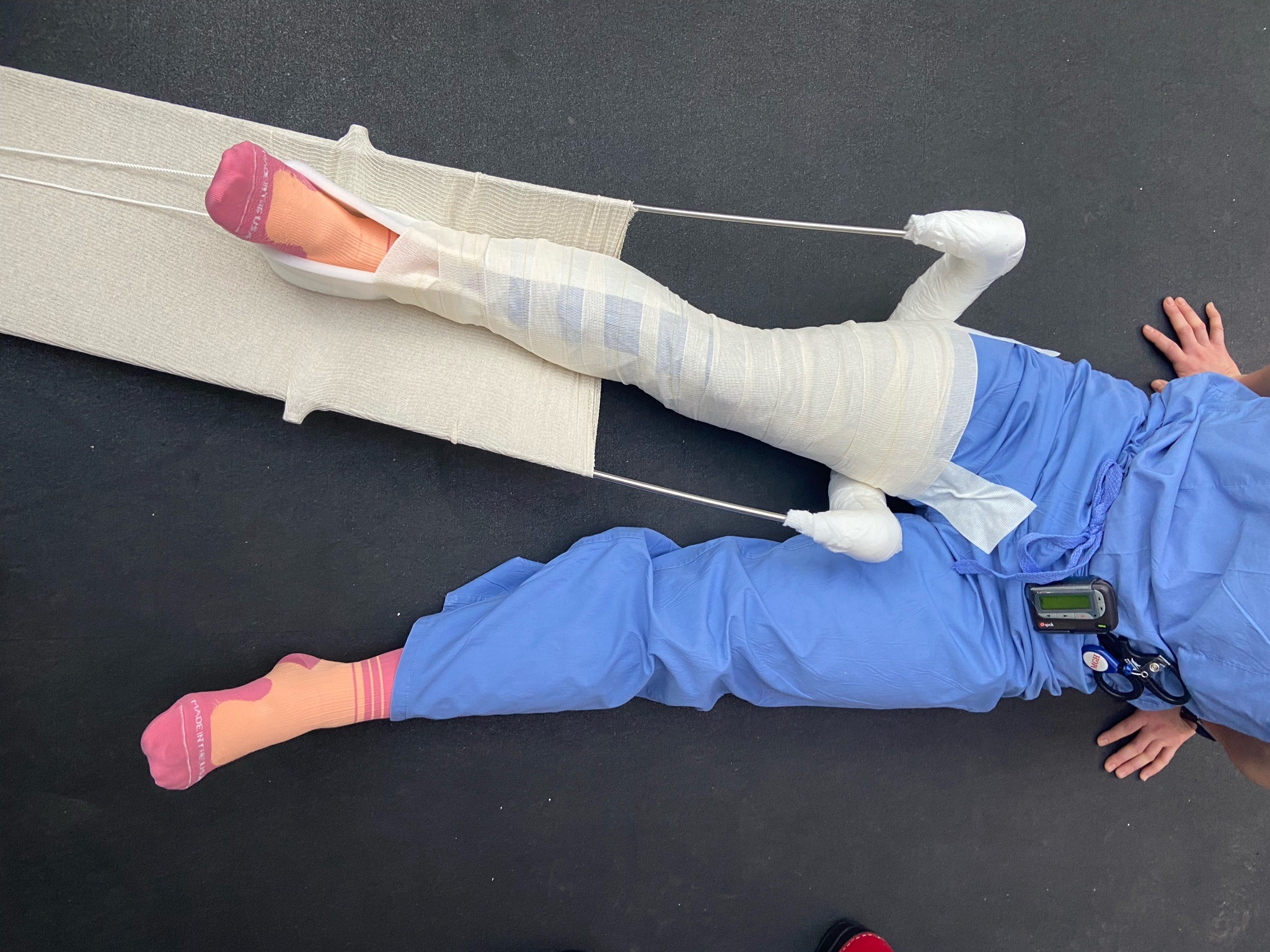 splint-thomassplint_wrapped