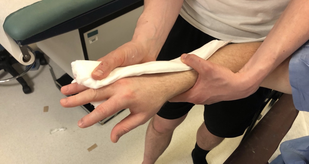 splint-ulnargutter_webril2